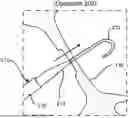 Fig. 01 - SYSTEM TO REDUCE CURRENT LOSS TO A SURROUNDING CONDUCTIVE MEDIUM FOR PURPOSES OF PUNCTURING TISSUE