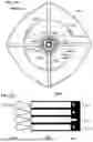 Fig. 15 - TRANSCATHETER DEVICE FOR INTERATRIAL ANASTOMOSIS