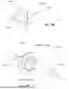 Fig. 19 - TRANSCATHETER DEVICE FOR INTERATRIAL ANASTOMOSIS