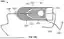 Fig. 35 - Catheter with a Double Balloon Structure to Generate and Apply a Heated Ablative Zone to Tissue