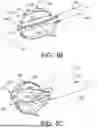 Fig. 05 - CONFIGURABLE MAP AND ABLATE CATHETER