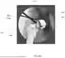 Fig. 28 - SYSTEMS AND METHODS FOR VISUALLY GUIDING BONE REMOVAL DURING A SURGICAL PROCEDURE ON A JOINT