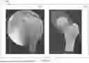 Fig. 35 - SYSTEMS AND METHODS FOR VISUALLY GUIDING BONE REMOVAL DURING A SURGICAL PROCEDURE ON A JOINT