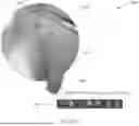 Fig. 40 - SYSTEMS AND METHODS FOR VISUALLY GUIDING BONE REMOVAL DURING A SURGICAL PROCEDURE ON A JOINT