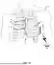 Fig. 02 - THORACIC ACCESS TUNNELING TOOL WITH LIGHT EMITTER FOR VISIBILITY