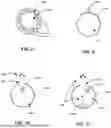Fig. 09 - THORACIC ACCESS TUNNELING TOOL WITH LIGHT EMITTER FOR VISIBILITY