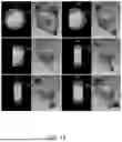 Fig. 07 - ASSISTED SURGICAL PLANNING SYSTEM AND OPERATION METHOD THEREOF