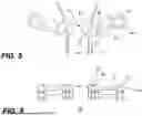 Fig. 05 - METHOD AND APPARATUS FOR TENSIONING A CONTROL WIRE OF A MEDICAL DEVICE