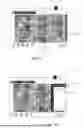 Fig. 34 - SURGICAL TRAY EFFICIENCY SYSTEM AND RELATED METHODS