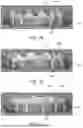 Fig. 08 - METHODS FOR DENTAL APPLIANCE RETENTION WITH TOPOGRAPHIC FEATURES