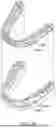 Fig. 32 - METHODS FOR DENTAL APPLIANCE RETENTION WITH TOPOGRAPHIC FEATURES