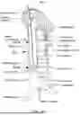 Fig. 22 - CAPTURING FLOWING DEBRIS IN THE VENA CAVA