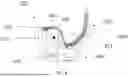 Fig. 09 - Total Stabilizing Knee Joint Prosthesis