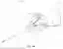 Fig. 45 - DYNAMIC SYNDESMOSIS IMPLANT SYSTEMS AND METHODS
