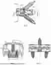 Fig. 07 - Interbody Implants And Instrumentation