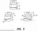 Fig. 06 - PROSTHETIC FOOT WITH SPACED SPRING ELEMENTS