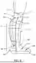 Fig. 03 - INSULATING DEVICE FOR AN ULCERATED DIABETIC FOOT