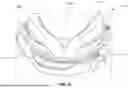 Fig. 06 - INTERFACING STRUCTURE FOR EYEWEAR