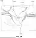 Fig. 09 - INTERFACING STRUCTURE FOR EYEWEAR