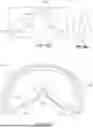 Fig. 67 - INTERFACING STRUCTURE FOR EYEWEAR