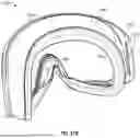 Fig. 99 - INTERFACING STRUCTURE FOR EYEWEAR