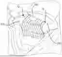 Fig. 01 - IMPLANTABLE POLYMER DEPOTS FOR THE CONTROLLED RELEASE OF THERAPEUTIC AGENTS