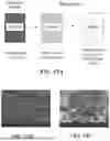 Fig. 15 - IMPLANTABLE POLYMER DEPOTS FOR THE CONTROLLED RELEASE OF THERAPEUTIC AGENTS