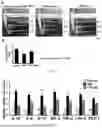 Fig. 08 - PHARMACEUTICAL COMPOSITION CONTAINING B-LAPACHONE AS ACTIVE INGREDIENT FOR PREVENTION OR TREATMENT OF CHOLESTATIC LIVER DISEASE