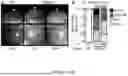 Fig. 09 - TREATING ELEVATED INTRAOCULAR PRESSURE WITH NICOTINAMIDE