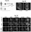 Fig. 08 - COMPOSITIONS AND METHODS FOR TREATING CARDIOMYOPATHIES
