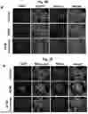 Fig. 09 - COMPOSITIONS AND METHODS FOR TREATING CARDIOMYOPATHIES