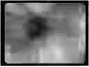 Fig. 01 - ECM HYDROGEL FOR TREATING ESOPHAGEAL INFLAMMATION