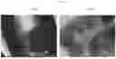 Fig. 49 - Compositions for Drug Delivery and Methods of Use Thereof