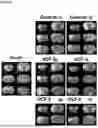 Fig. 07 - ACELLULAR ALLOGENIC EXOSOME PREPARATIONS AND METHODS OF USE