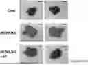 Fig. 01 - COMPOSITIONS AND METHODS FOR PREVENTING, ALLEVIATING, OR TREATING LIVER DISEASE