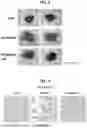 Fig. 08 - COMPOSITIONS AND METHODS FOR PREVENTING, ALLEVIATING, OR TREATING LIVER DISEASE