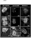 Fig. 08 - METHODS OF DELIVERING A VIRAL VECTOR TO A KIDNEY