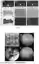 Fig. 02 - TISSUE ENGINEERING CARTILAGE CONSTRUCTED BASED ON DECALCIFIED BONE SCAFFOLD AND USE THEREOF