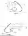 Fig. 07 - VENT FOR A COMPONENT OF A RESPIRATORY THERAPY SYSTEM