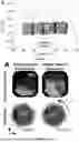 Fig. 22 - MICROROBOTS WITH DISTRIBUTED ACTUATION