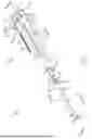 Fig. 02 - CATHETER SYSTEM AND METHOD OF INTRODUCING AN INTRAVENOUS CATHETER INTO A PATIENT