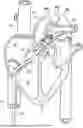 Fig. 01 - INTRAVASCULAR BLOOD PUMP WITH BALLOON