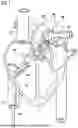 Fig. 02 - INTRAVASCULAR BLOOD PUMP WITH BALLOON
