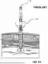 Fig. 06 - DUAL-DEPLOYMENT SUTURE PLACEMENT & ANESTHESIA DELIVERY APPLIANCE AND RELATED DEVICES AND METHODS
