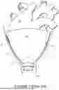 Fig. 02 - DIRECT CARDIAC COMPRESSION DEVICE WITH PERICARDIAL ELECTRODES