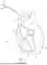 Fig. 02 - CARDIAC ELECTRODE ASSEMBLY WITH ANTI-MIGRATION FEATURE