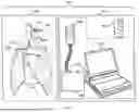 Fig. 02 - OBSTRUCTIVE SLEEP APNEA TREATMENT DEVICES, SYSTEMS AND METHODS