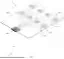 Fig. 08 - SYSTEM AND METHODS FOR RESIDUAL LIMBS OF AMPUTEES