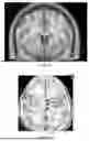 Fig. 07 - TARGETED NEUROMODULATION TO IMPROVE NEUROPSYCHIATRIC FUNCTION