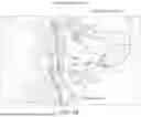 Fig. 04 - IMPLANTABLE ELECTRODES WITH REMOTE POWER DELIVERY FOR TREATING SLEEP APNEA, AND ASSOCIATED SYSTEMS AND METHODS